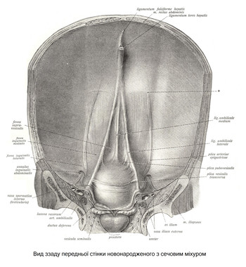 Вид ззаду передньої стінки новонародженого з сечовим міхуром