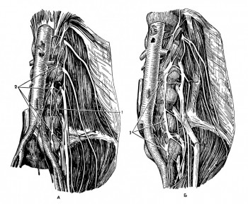 поясничного отдела левого пограничного ствола симпатического нерва