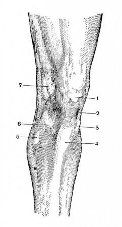 Определяемые на поверхности тела образования области коленного сустава