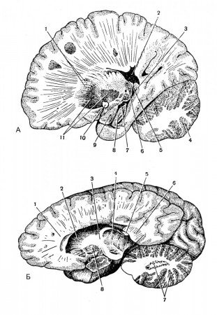 Продольные  разрезы головного мозга на разных уровнях