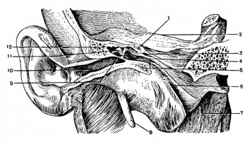 Барабанная полость и слуховая труба на фронтальном  распиле черепа