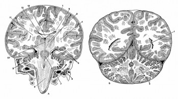 Фронтальные разрезы мозга (по Н. И. Пирогову)