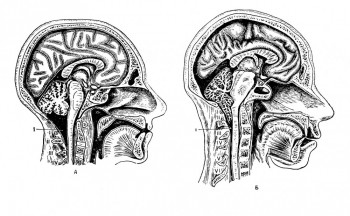 Различия формы большой цистерны мозга