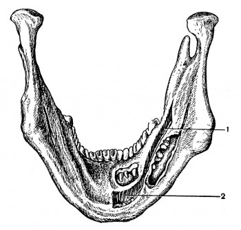 Расположение m. mylohyoideus по отношению к корням зубов