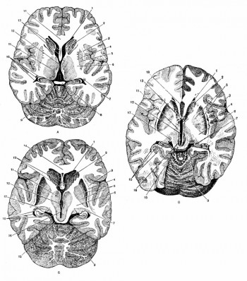 Поперечные разрезы мозга на разных уровнях