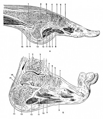 Продольные (парасагиттальные) распилы левой стопы