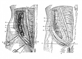 Различия в строении нервов паховой области (второй межмышечный слой)