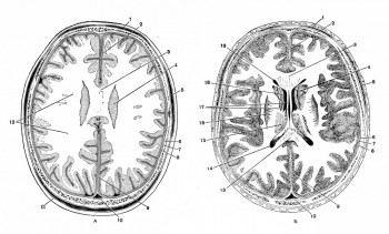Поперечные разрезы черепа и мозга на разных уровнях