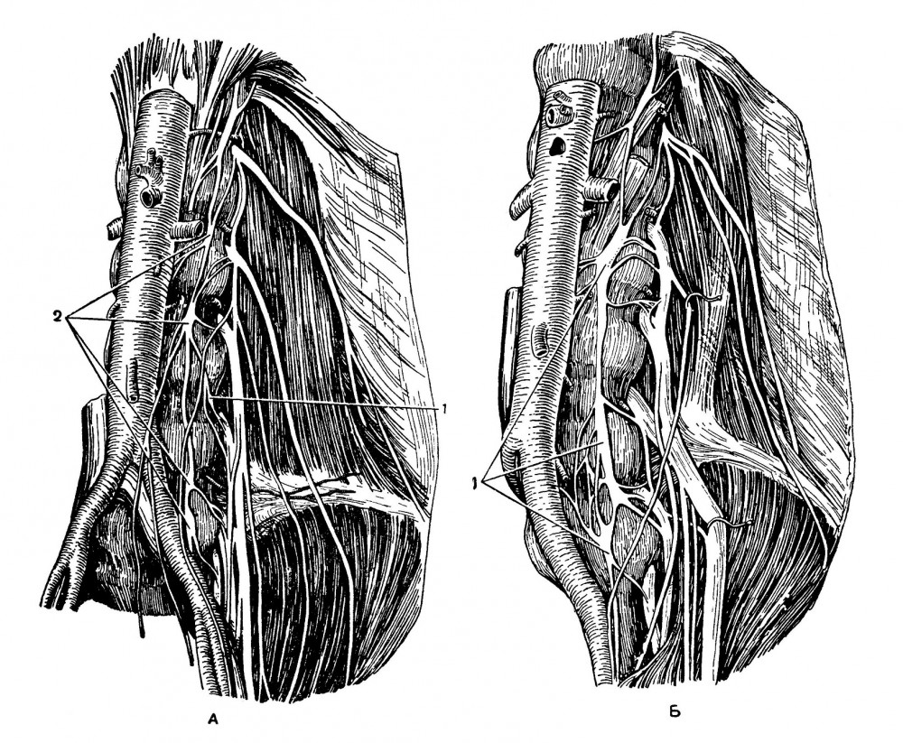 поясничного отдела левого пограничного ствола симпатического нерва