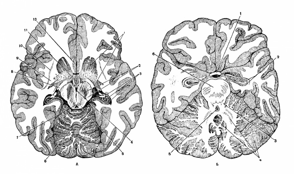 Поперечные разрезы мозга на разных уровнях