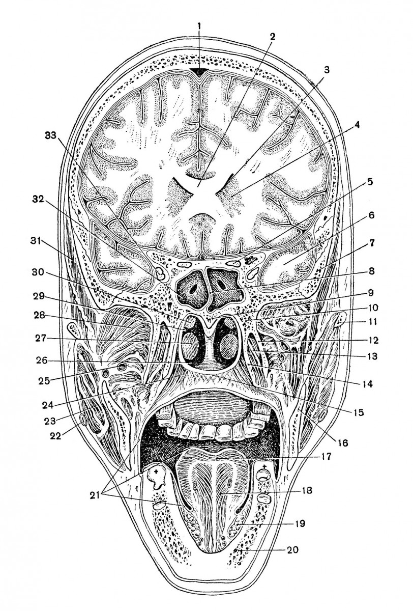 Фронтальный разрез мозга по Н. И. Пирогову