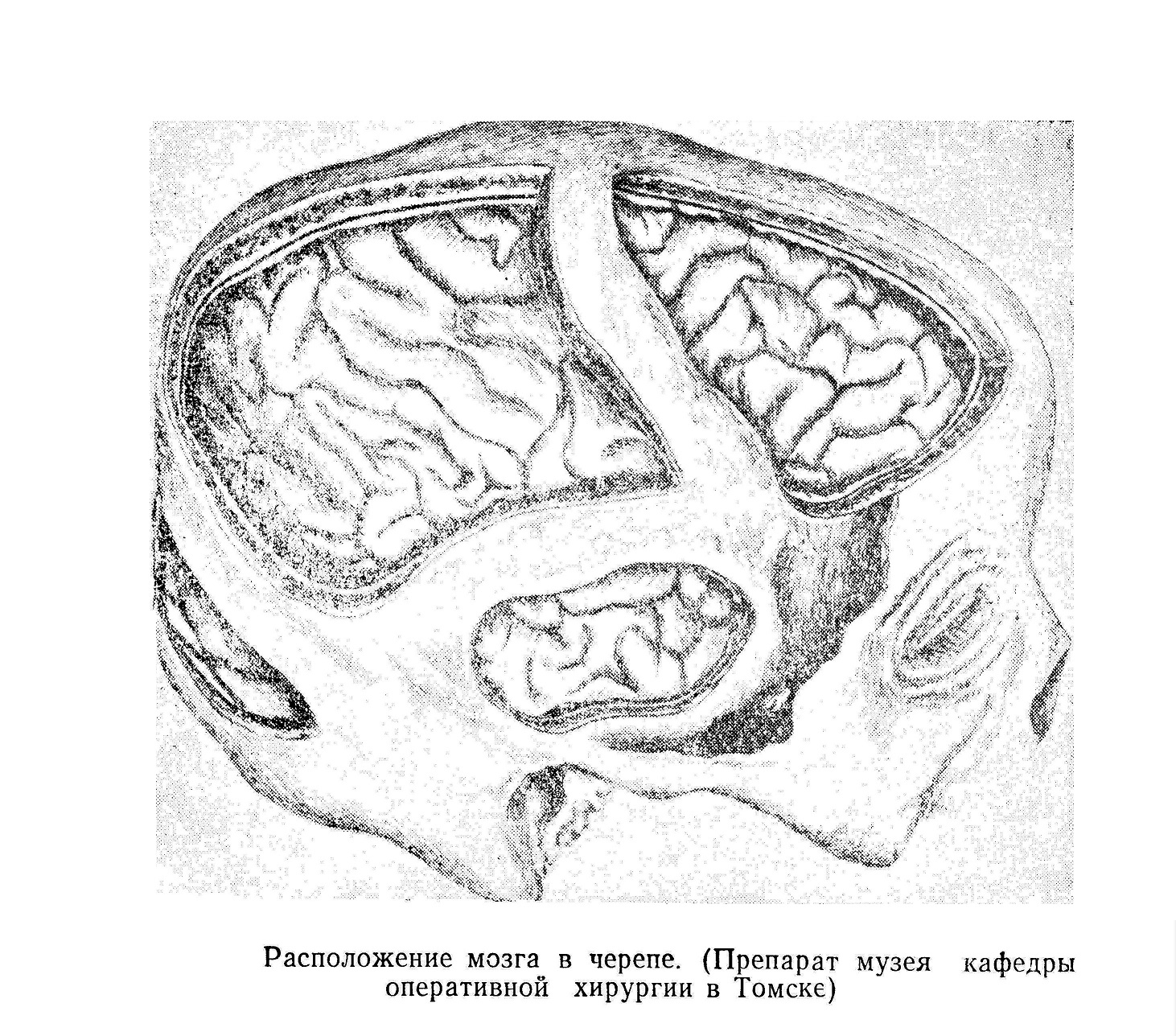 Расположение мозга в черепе