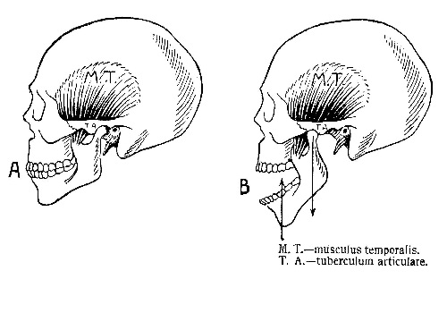 Нижнечелюстной сустав — articulatio mandibularis
