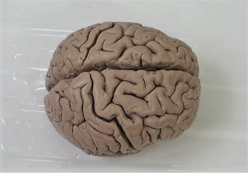 Мозжечок (cerebellum)