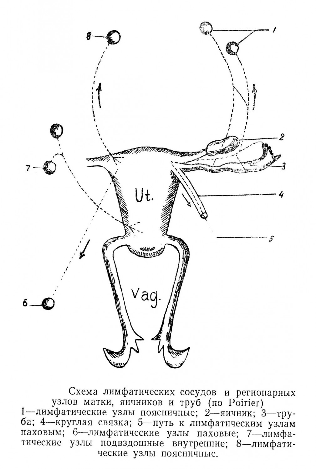 Схема лимфатических сосудов и регионарных узлов матки, яичников и труб