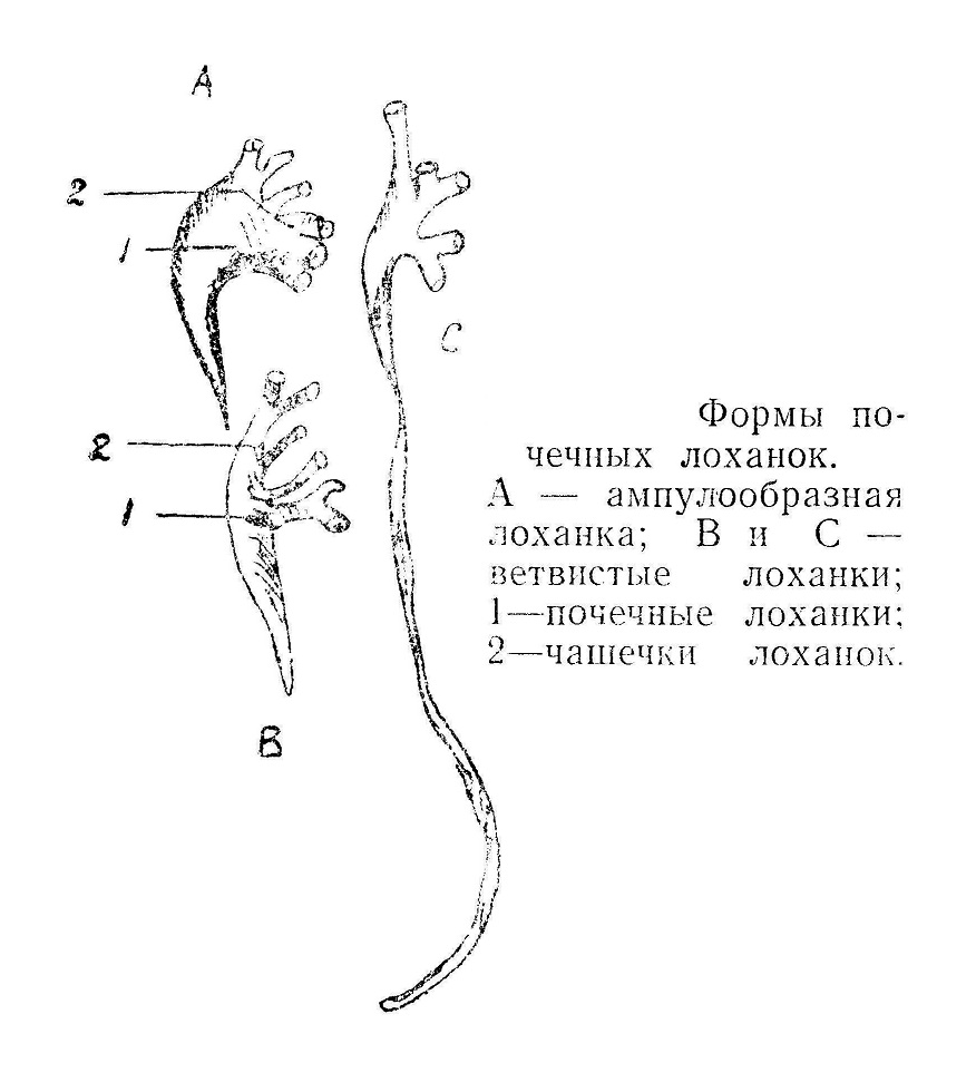 Формы почечных лоханок