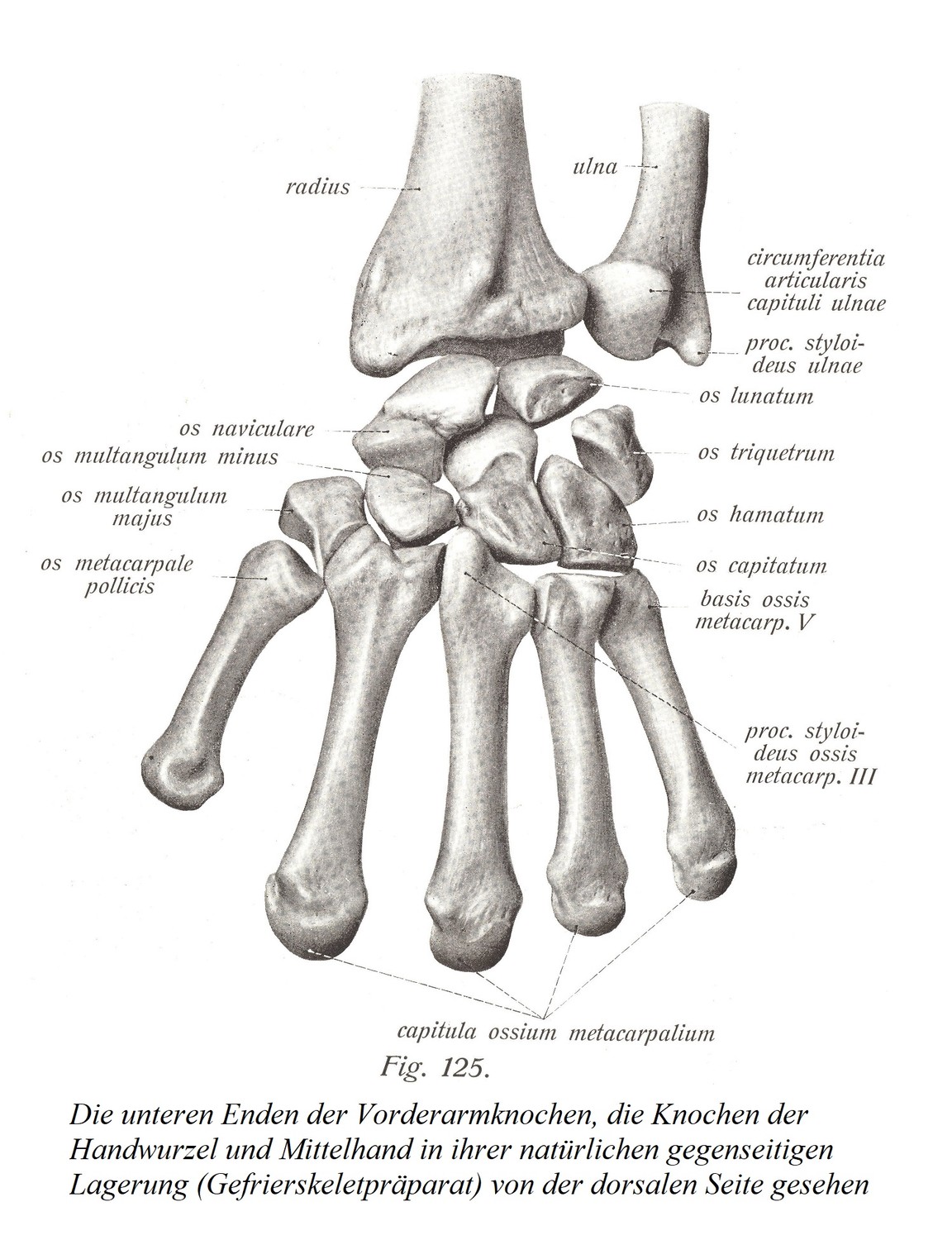 Knochen der (linken) Hand, ossa manus (sinistrae)