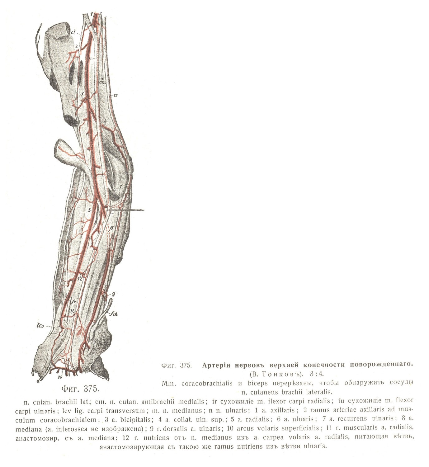 Артерии нервов верхней конечности новорождённого.