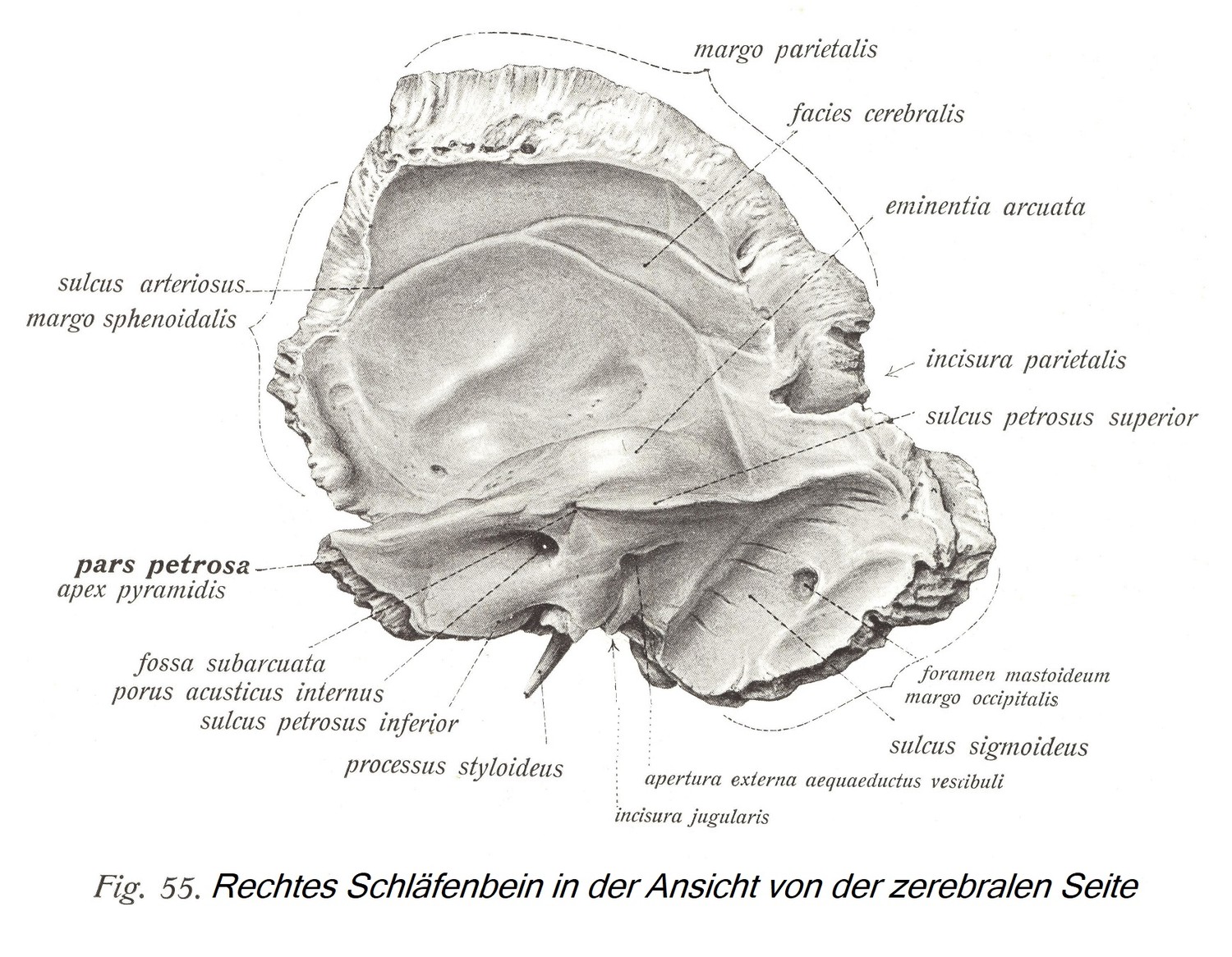 Правая височная кость, вид с мозговой стороны