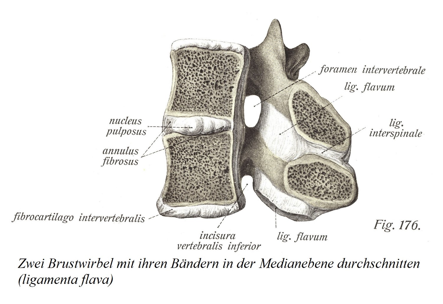 Два грудных позвонка с их связками, разделенными в срединной плоскости (ligamenta flava)
