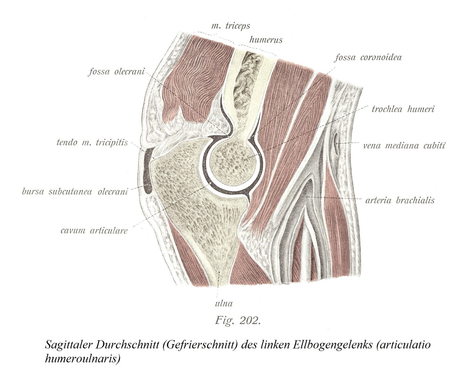 Сагиттальный срез (замороженный срез) левого локтевого сустава (articulatio humeroulnaris).