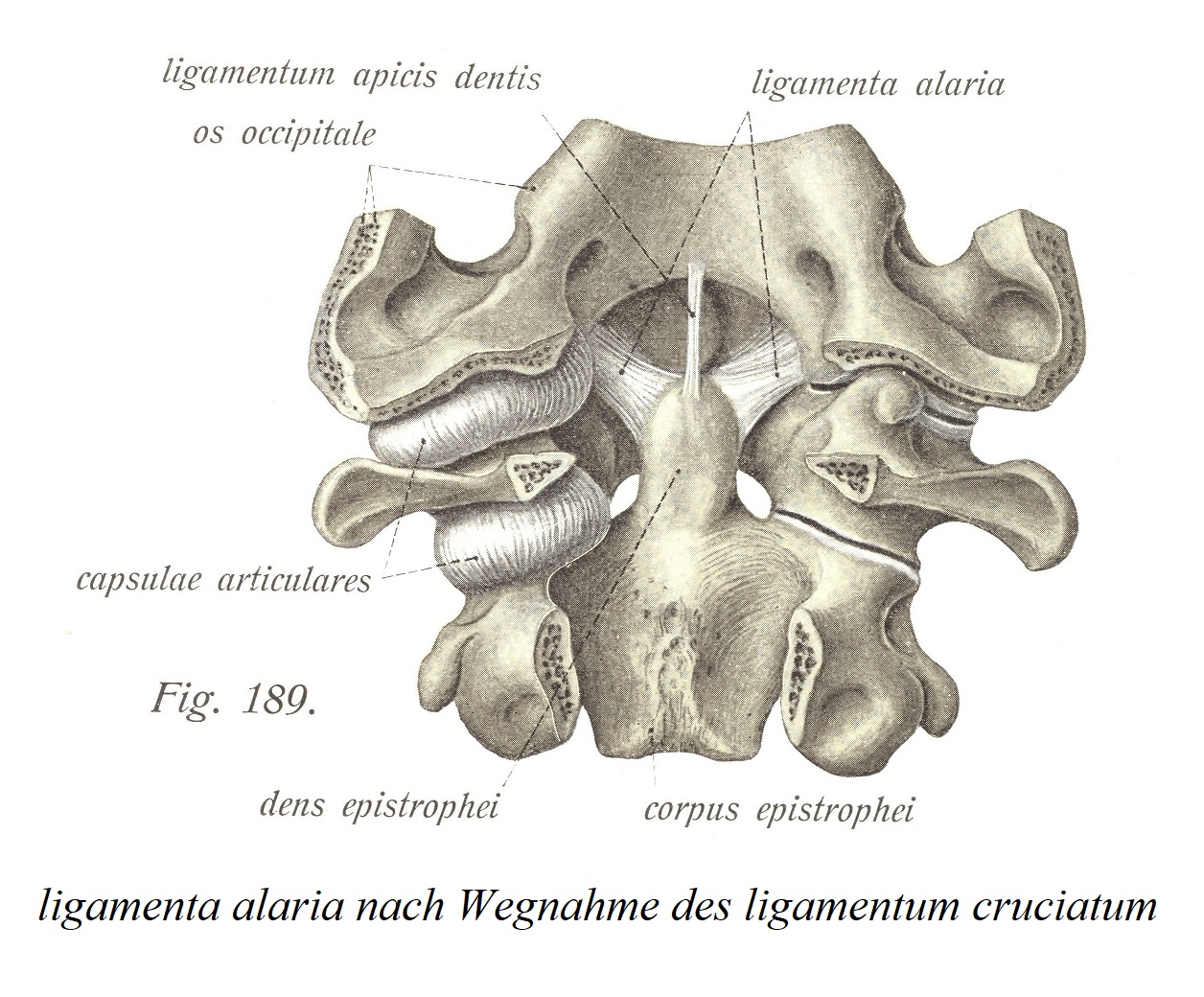 ligamenta alaria после удаления крестообразной связки