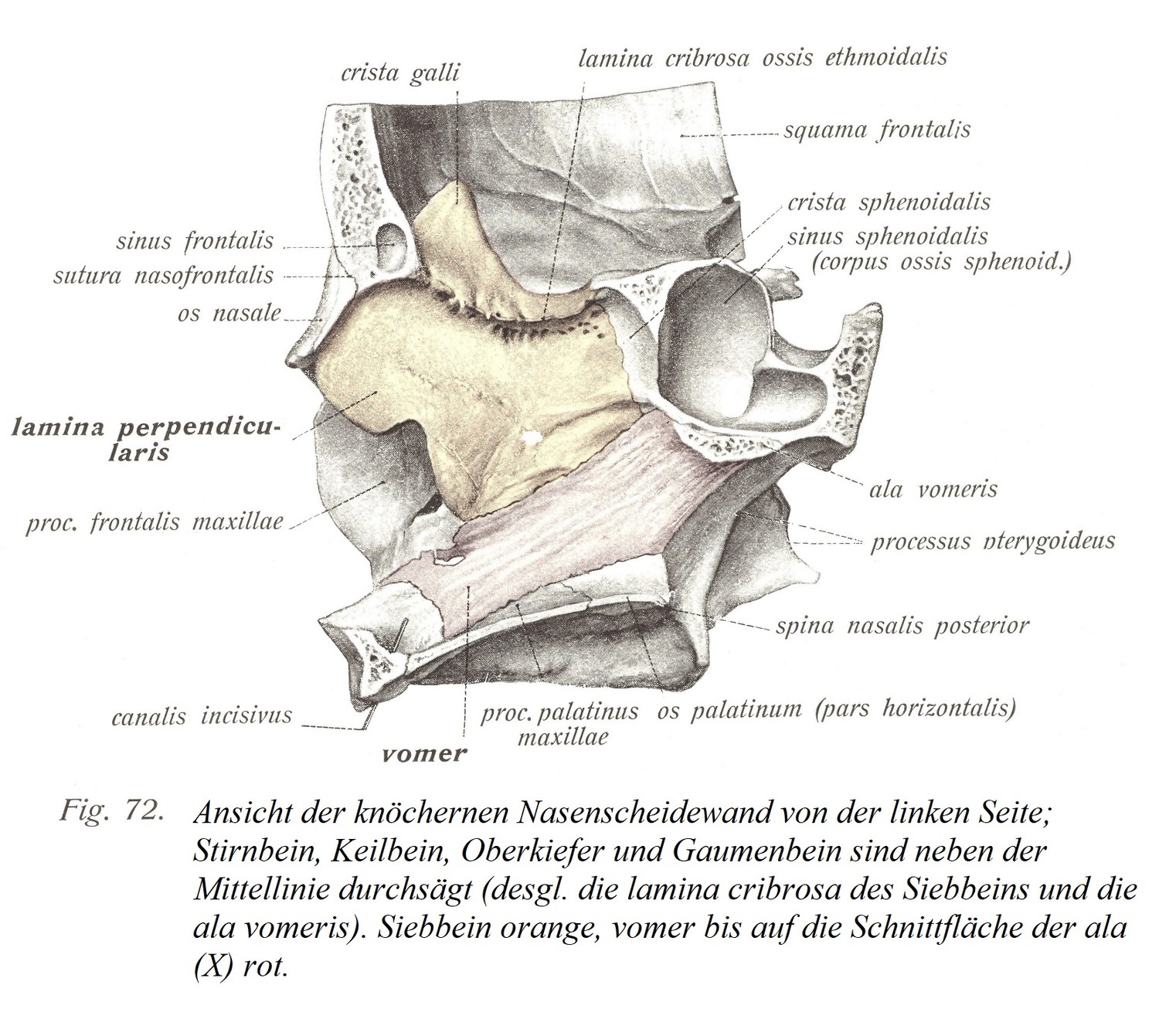 Вид костной перегородки носа слева; Лобная кость, клиновидная кость, верхняя и небная кости рассекаются по средней линии (также решетчатая пластинка решетчатой ​​кости и сошник). Решетчатая кость оранжевая, красная спереди до поверхности разреза крыла (X).