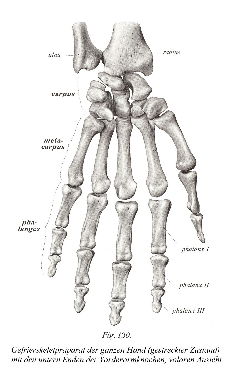 Замороженный скелетный препарат целой кисти (растянутое состояние) с нижними концами костей предплечья, ладонная проекция