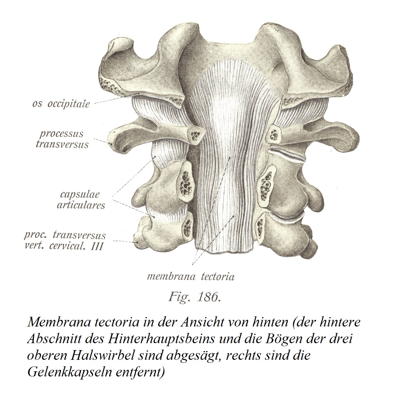 Membrana tectoria в проекции сзади (отпилены задняя часть затылочной кости и дуги трех верхних шейных позвонков, удалены суставные капсулы справа).