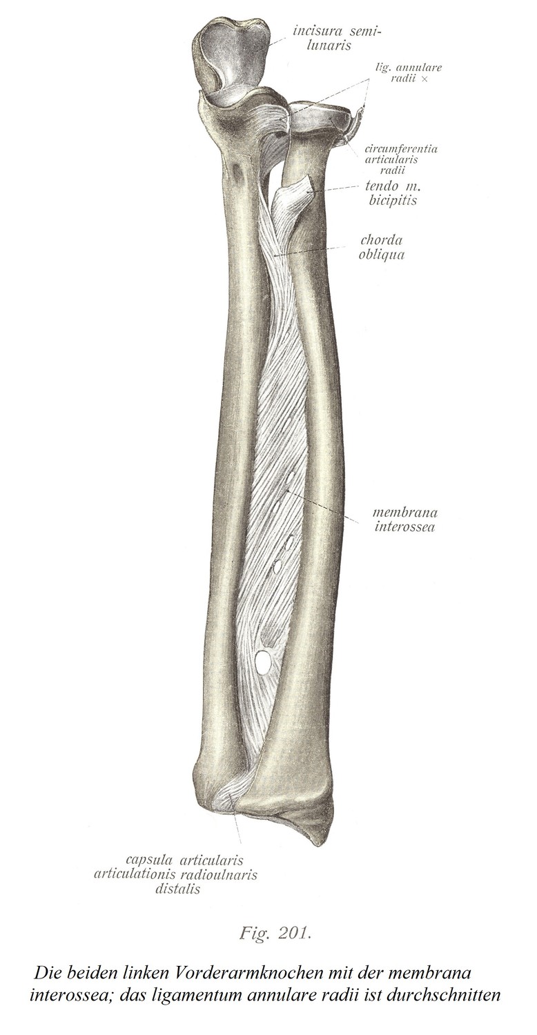 Две кости левого предплечья с межкостной перепонкой; кольцевая связка лучевой кости была разделена