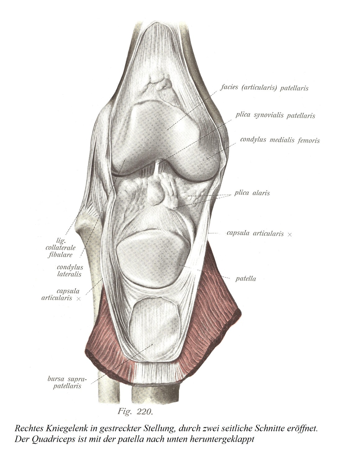 Правый коленный сустав в вытянутом положении, вскрыт двумя боковыми разрезами. Четырехглавая мышца сгибается надколенником вниз.