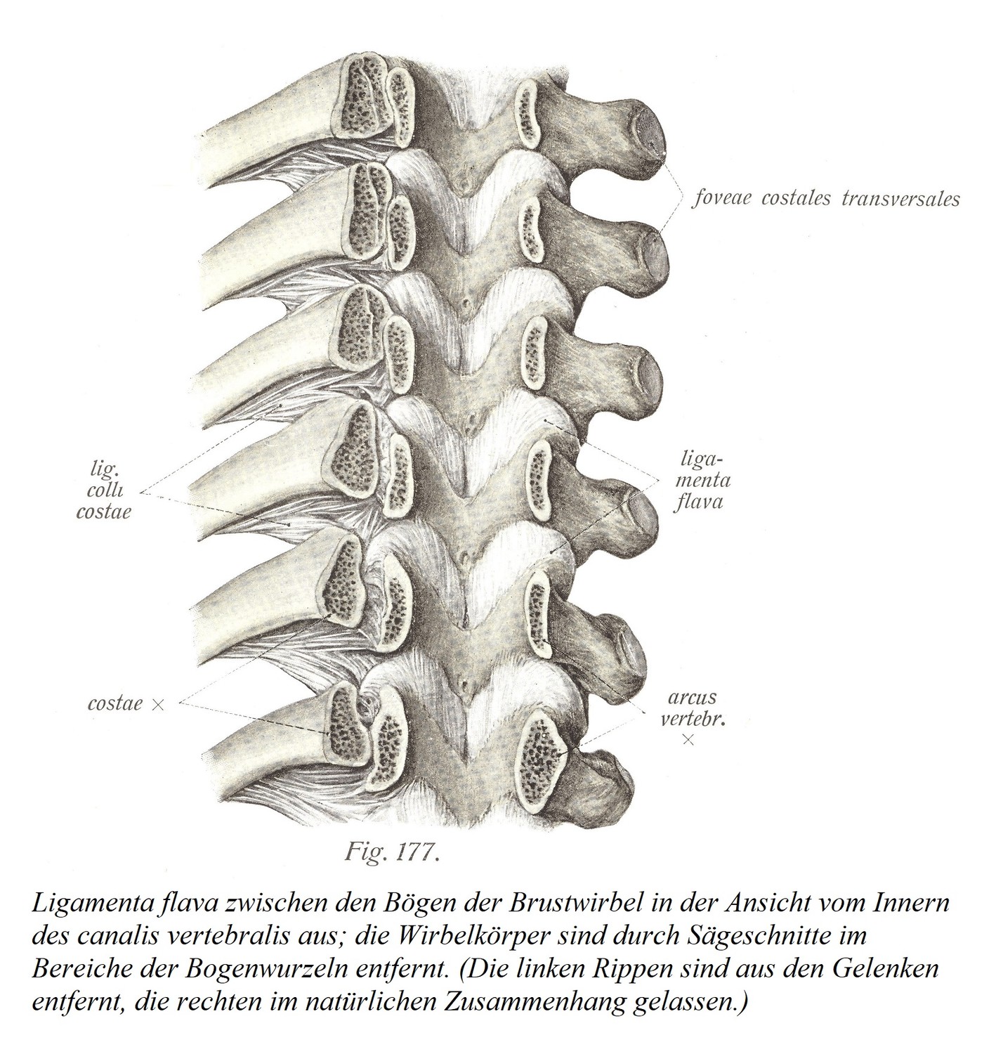 Ligamenta flava между дугами грудных позвонков, если смотреть изнутри позвоночного канала; тела позвонков удалены распилами в области корней дуг. (Левые ребра удалены из суставов, правые ребра оставлены в естественном контексте.) 