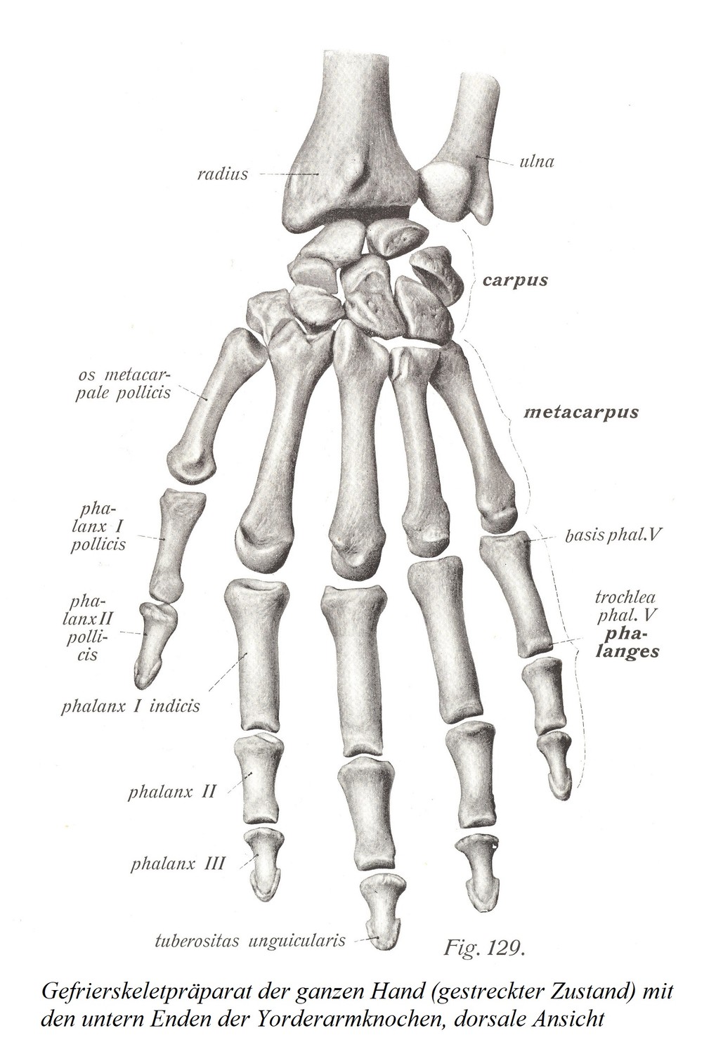 Замороженный скелетный препарат целой кисти (растянутое состояние) с нижними концами костей предплечья, вид с тыльной стороны