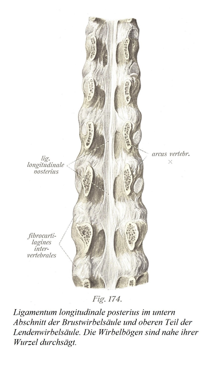 Продольная задняя связка в нижней части грудного отдела позвоночника и верхней части поясничного отдела позвоночника. Дуги позвонков рассекают у их корней.
