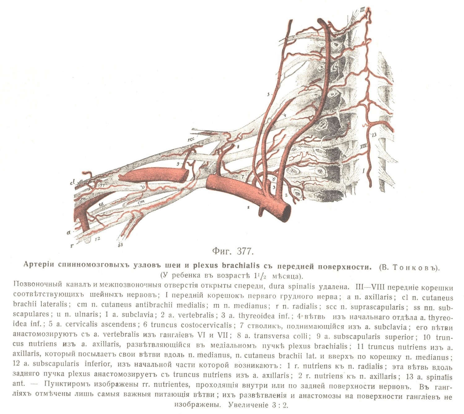 Артеріи спинномозговыхъ узловъ шеи и plexus brachialis съ передней поверхности