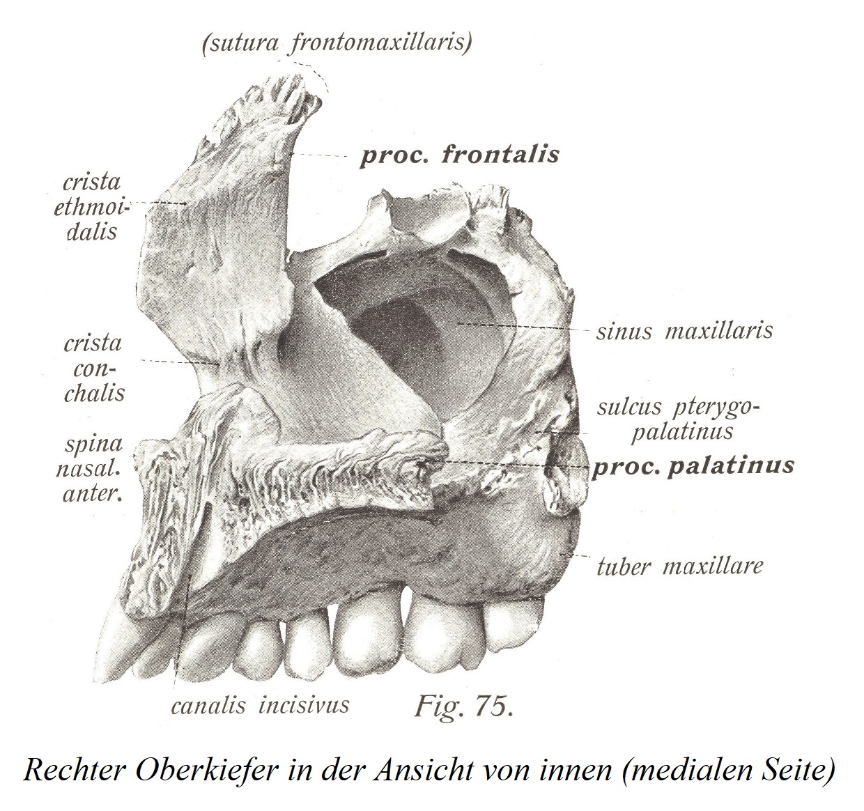Правая верхняя челюсть, вид изнутри (медиальная сторона)