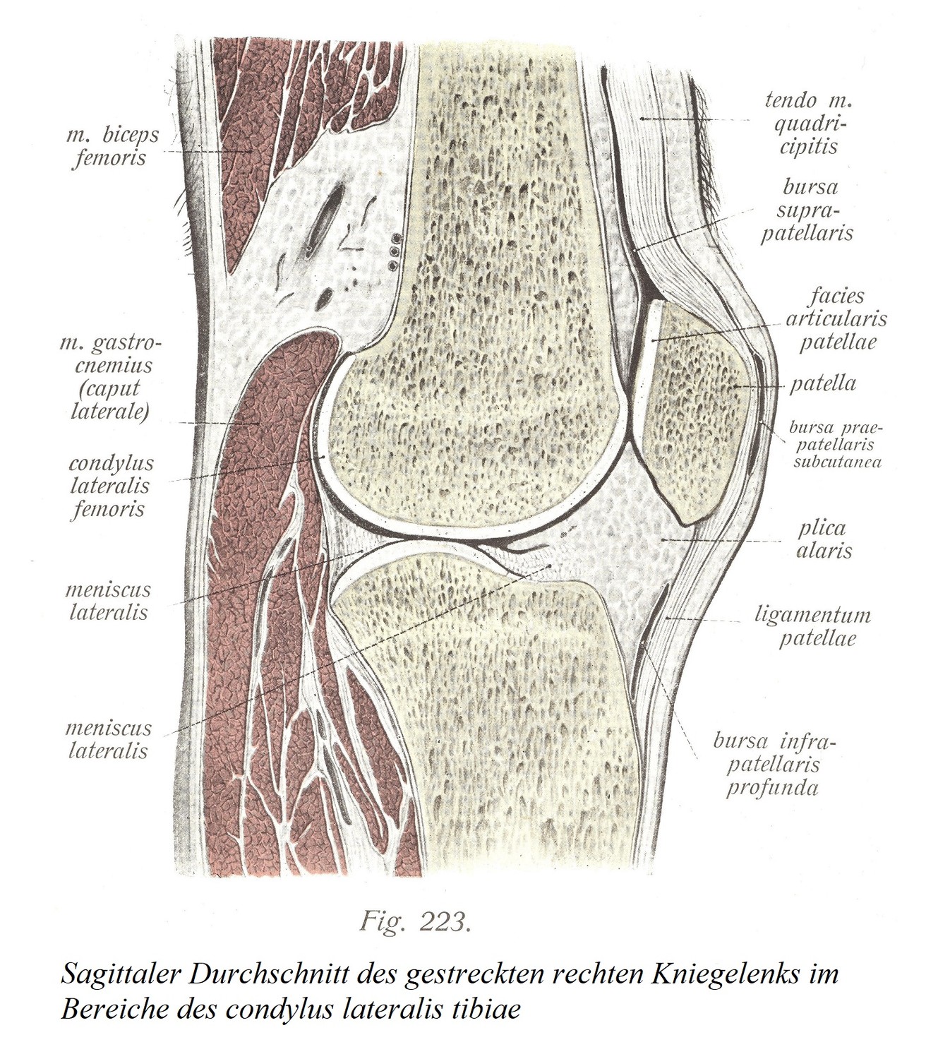 Сагиттальный разрез разогнутого правого коленного сустава в области латерального мыщелка большеберцовой кости