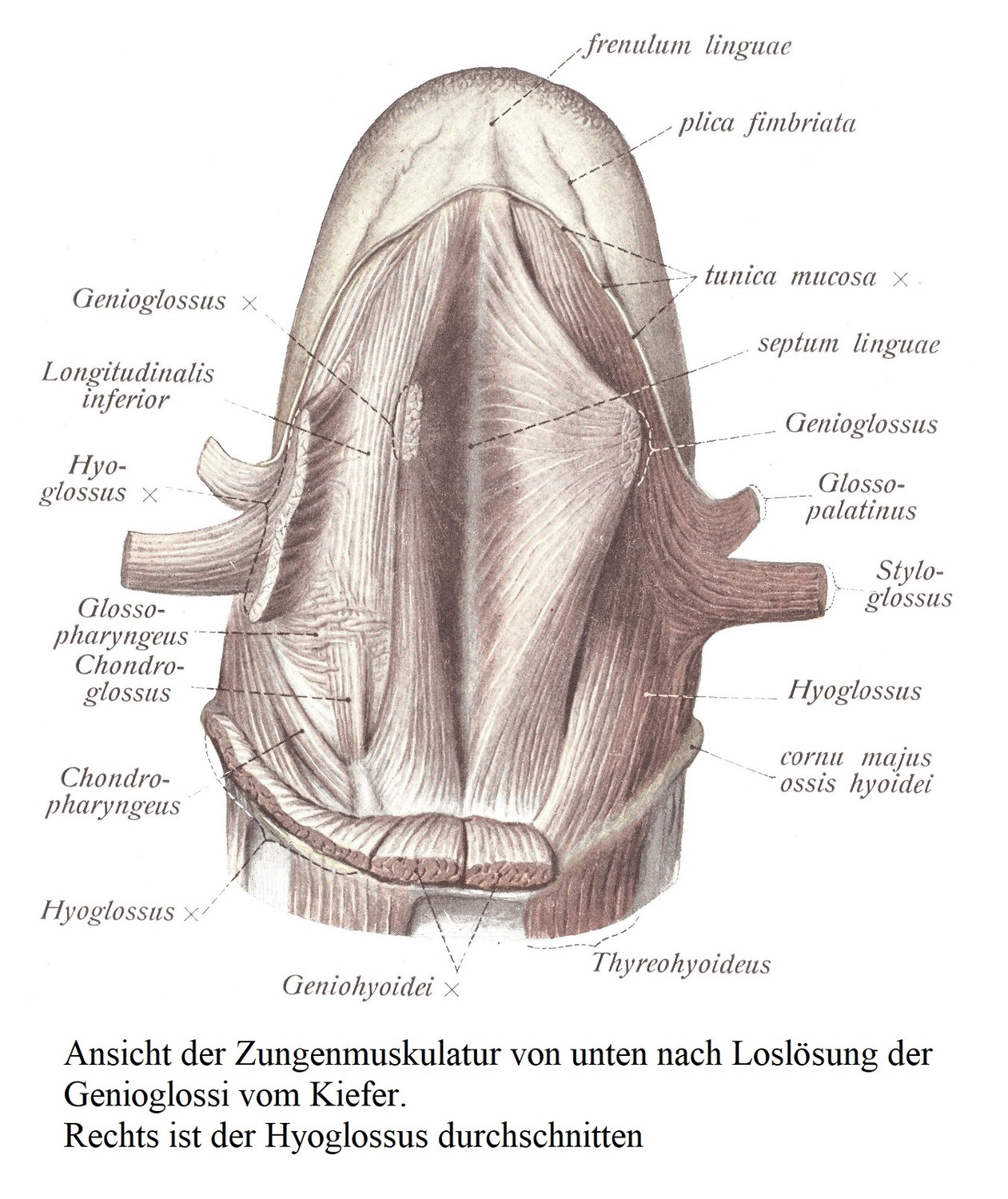 Вид мышц языка снизу после отделения подбородочно-язычных мышц от челюсти. Подъязычная мышца разделена справа