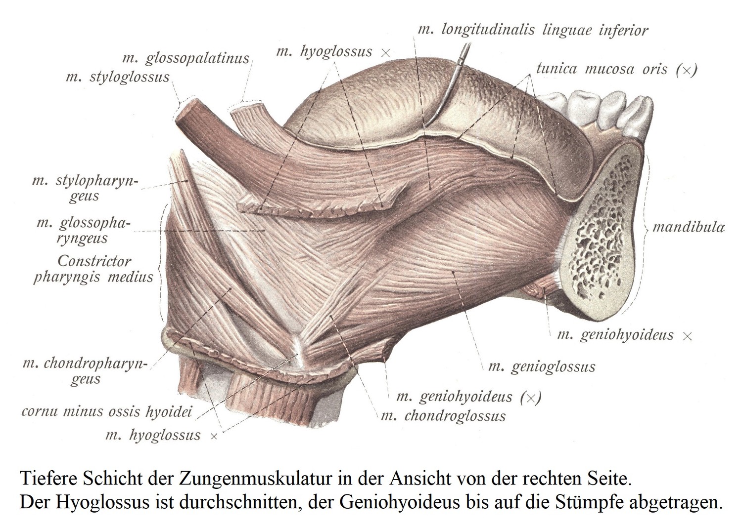 Глубокий слой мускулатуры языка, вид справа. Рассечена подъязычная, подбородочно-подъязычная удалена до культей.
