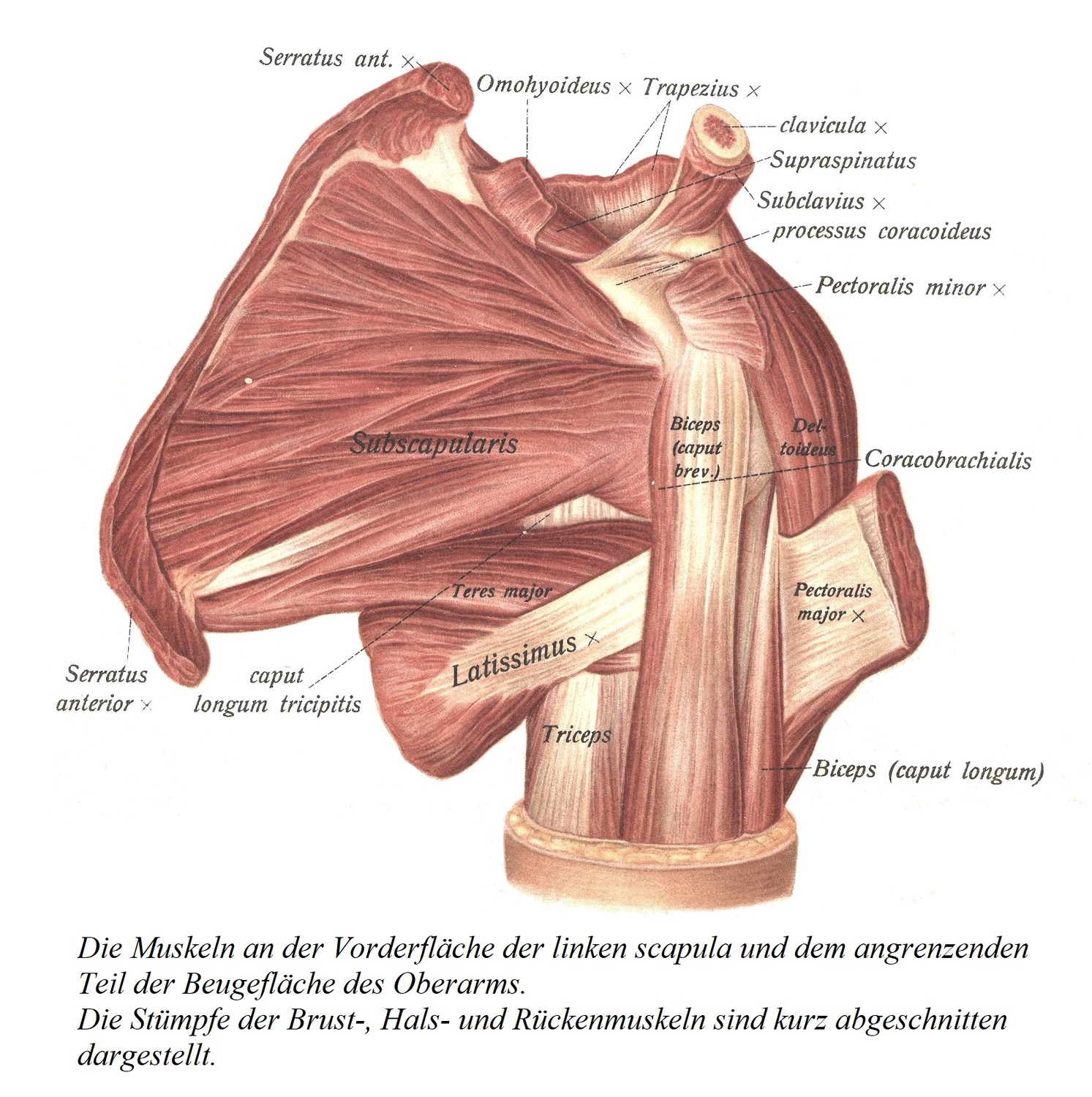 Мышцы передней поверхности левой лопатки и прилежащего участка сгибательной поверхности плечевой кости. Культи грудной клетки, шеи и мышц спины показаны коротко остриженными.