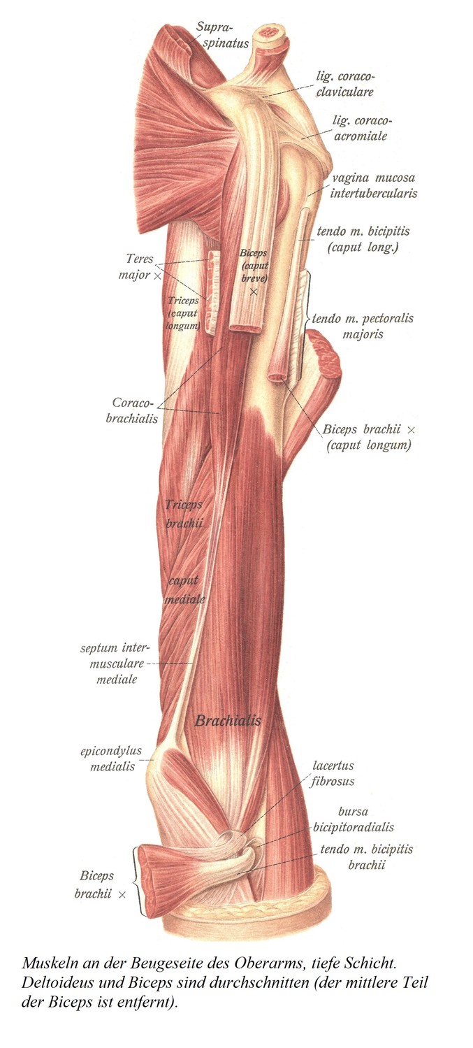 Мышцы сгибательной стороны плеча, глубокий слой. Рассекаются дельтовидные мышцы и бицепсы (удаляется средняя часть бицепса).