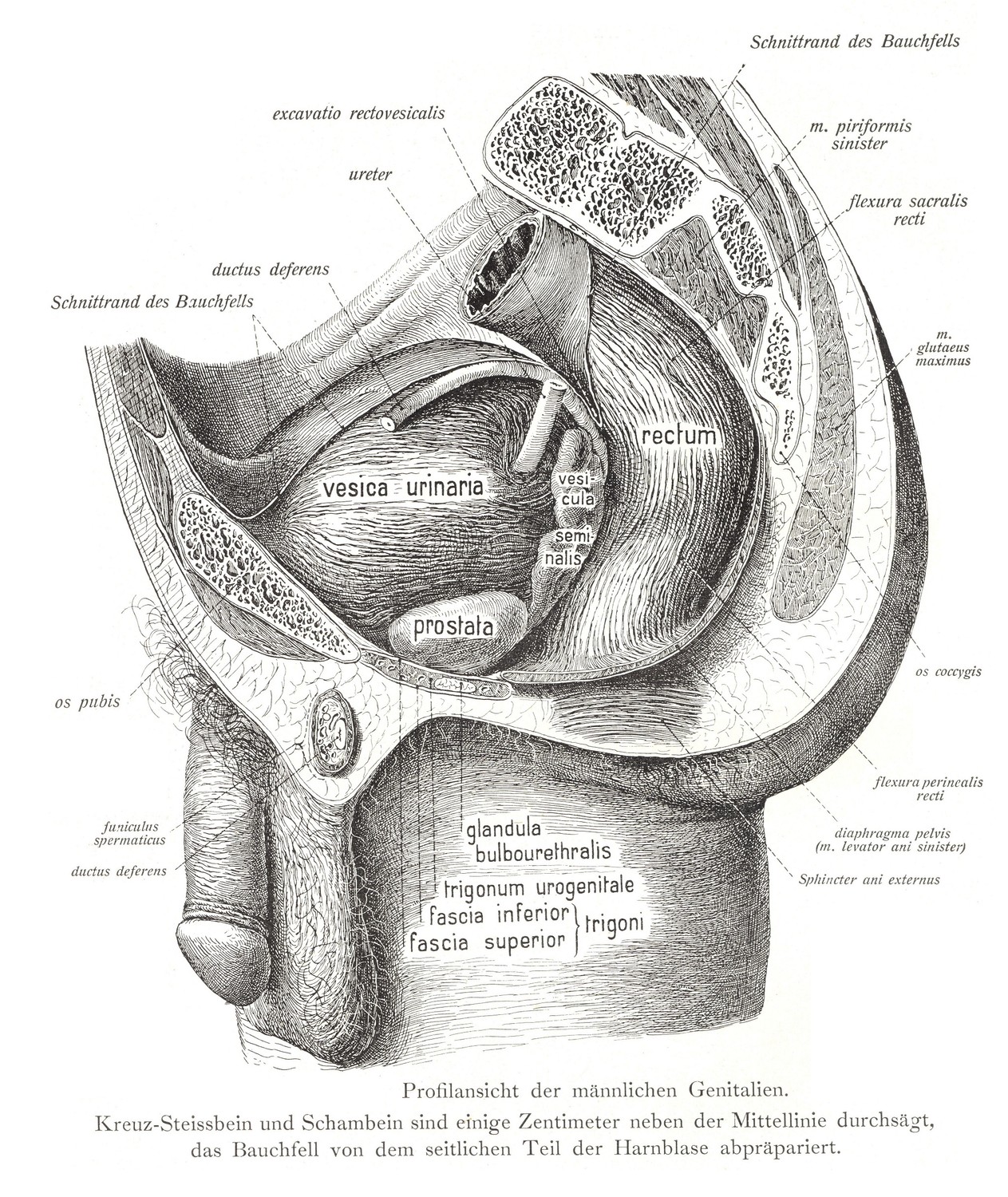 Профиль мужских гениталий. Крестец, копчик и лобковая кость распилены на несколько сантиметров от средней линии, брюшину рассекают от латеральной части мочевого пузыря.
