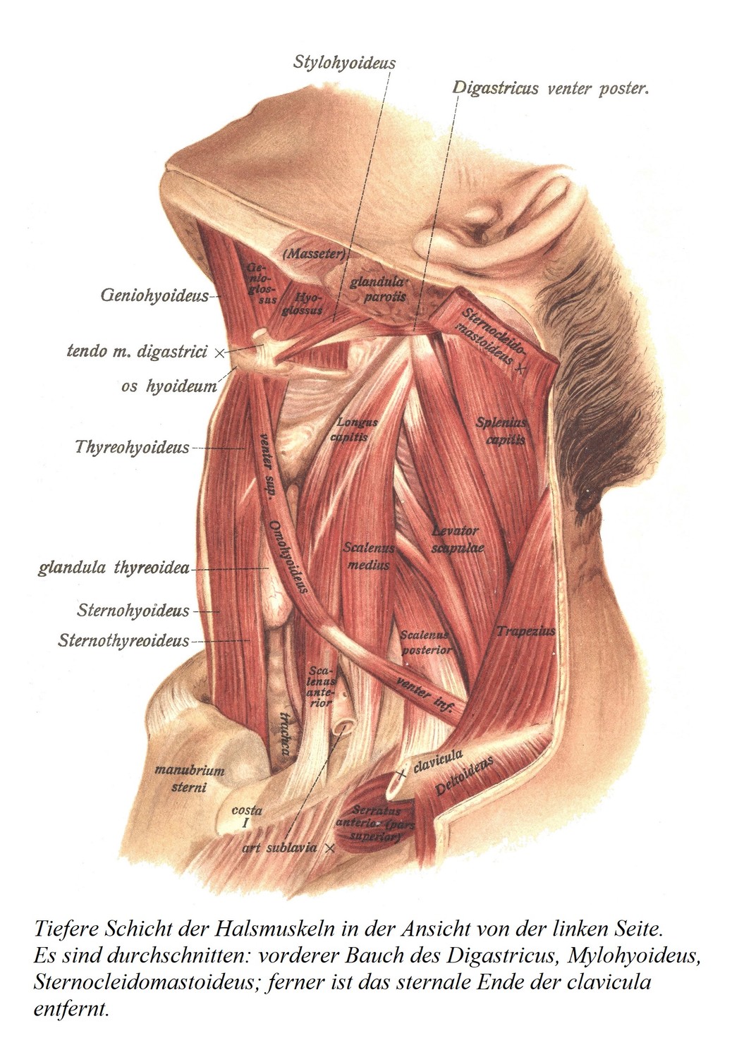 Глубокий слой мышц шеи при осмотре слева. Рассекают: переднее брюшко двубрюшной мышцы, подъязычно-подъязычную мышцу, грудино-ключично-сосцевидную мышцу; кроме того, удаляется грудинный конец ключицы.