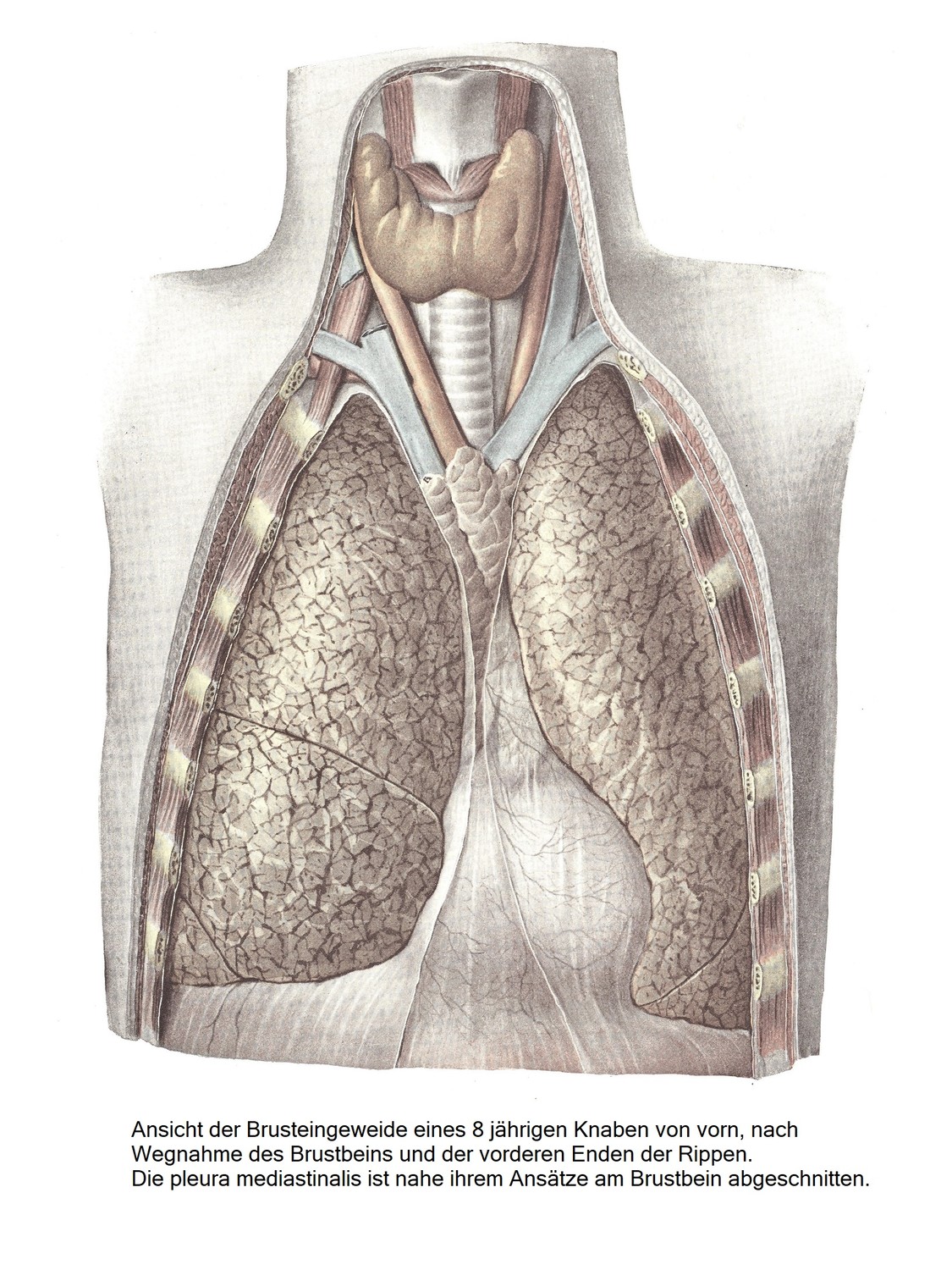Вид спереди внутренних органов грудной клетки 8-летнего мальчика после удаления грудины и передних концов ребер. Медиастинальная плевра отсекается в месте ее прикрепления к грудине.