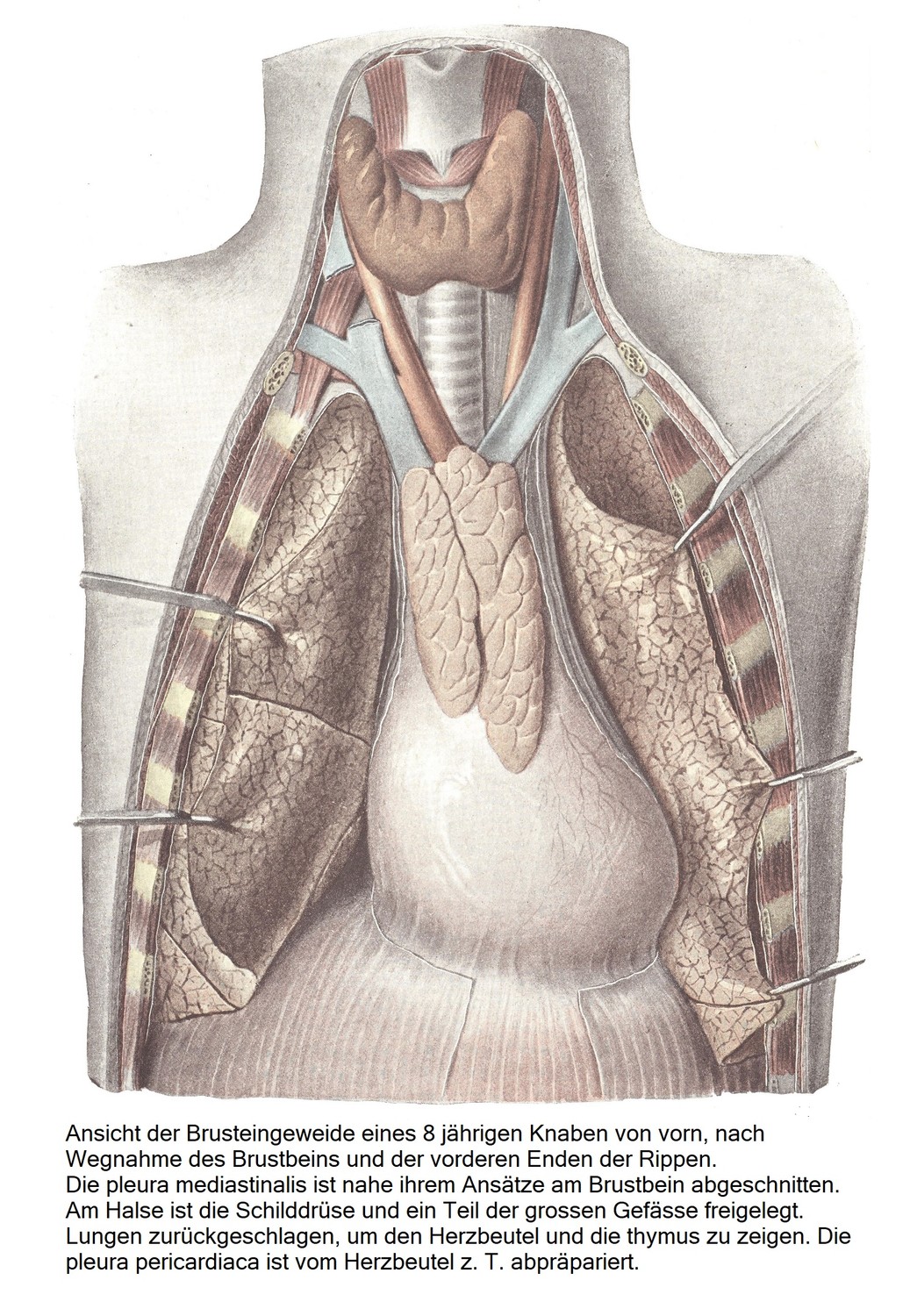 Вид спереди внутренних органов грудной клетки 8-летнего мальчика после удаления грудины и передних концов ребер. Медиастинальная плевра отсекается в месте ее прикрепления к грудине. На шее обнажают щитовидную железу и часть крупных сосудов. Легкие отогнуты назад, чтобы показать перикард и тимус. Перикардиальная плевра отделена от перикарда 
