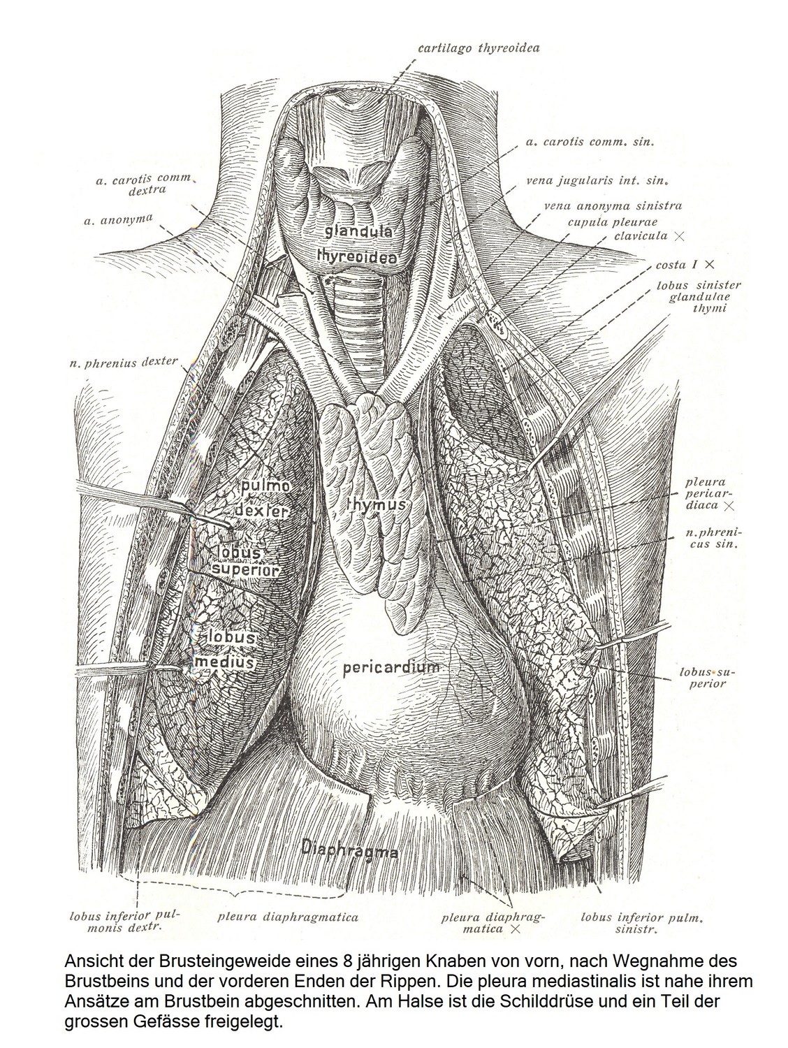 Вид спереди внутренних органов грудной клетки 8-летнего мальчика после удаления грудины и передних концов ребер. Медиастинальная плевра отсекается в месте ее прикрепления к грудине. На шее обнажают щитовидную железу и часть крупных сосудов.