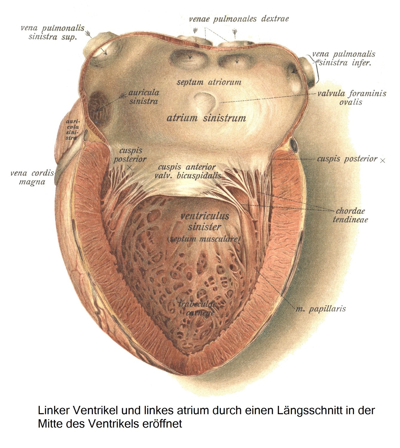 Левый желудочек и левое предсердие, вскрытые продольным разрезом посередине желудочка.