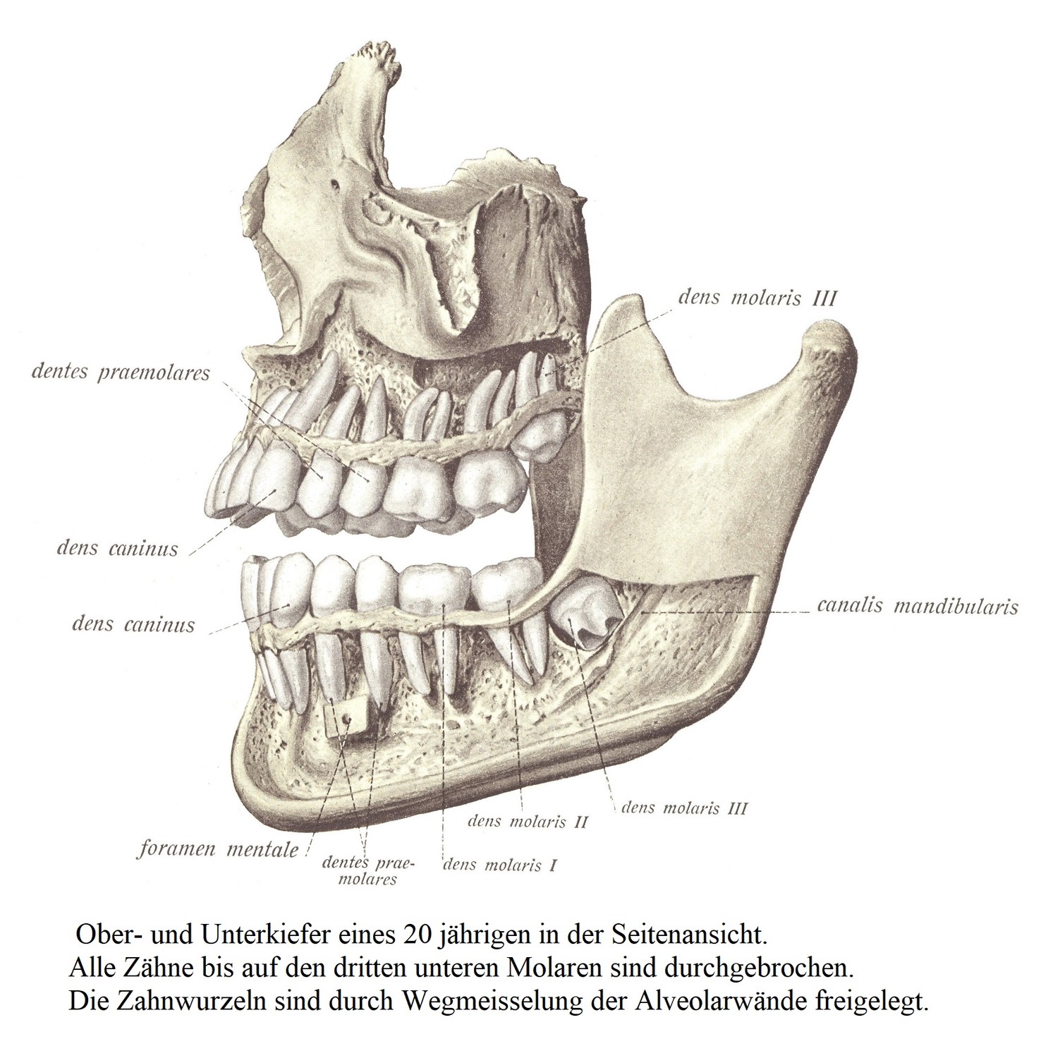 Боковой вид верхней и нижней челюсти мужчины 20 лет. Все зубы прорезались, кроме третьего нижнего моляра. Корни зубов обнажаются путем срезания альвеолярных стенок.