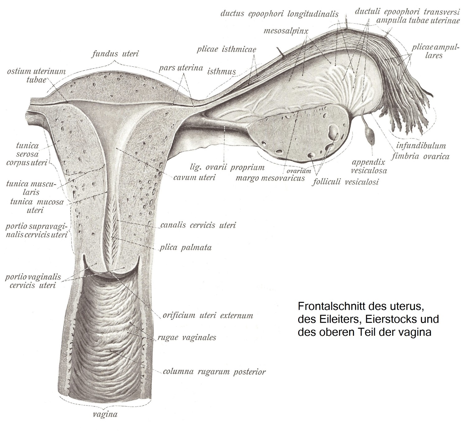 Фронтальный разрез матки, маточной трубы, яичника и верхней части влагалища