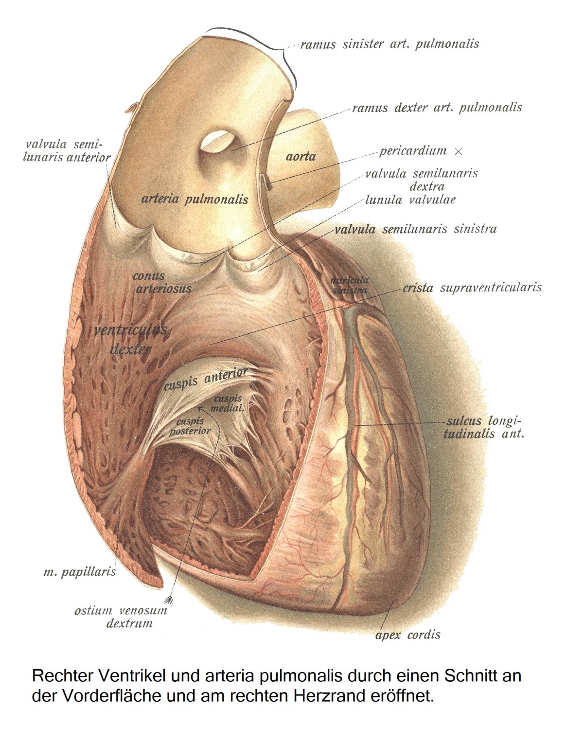 Правый желудочек и легочная артерия, вскрытые разрезом по передней поверхности и правому краю сердца.